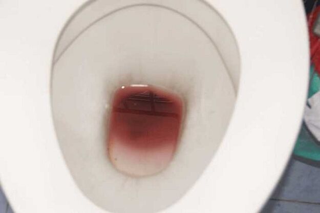 erutumisel meestel määrimine